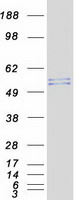 JUB / Ajuba Protein - Purified recombinant protein AJUBA was analyzed by SDS-PAGE gel and Coomassie Blue Staining