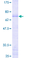 JUNB / JUN-B Protein - 12.5% SDS-PAGE of human JUNB stained with Coomassie Blue