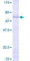 JUNB / JUN-B Protein - 12.5% SDS-PAGE of human JUNB stained with Coomassie Blue