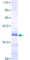 JUNB / JUN-B Protein - 12.5% SDS-PAGE Stained with Coomassie Blue.