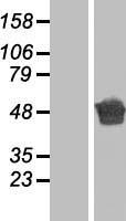 Junctin / ASPH Protein - Western validation with an anti-DDK antibody * L: Control HEK293 lysate R: Over-expression lysate