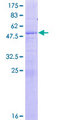 Junctin / ASPH Protein - 12.5% SDS-PAGE of human ASPH stained with Coomassie Blue