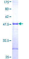 Junctin / ASPH Protein - 12.5% SDS-PAGE Stained with Coomassie Blue.