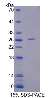 Junctin / ASPH Protein - Recombinant  Aspartate Beta Hydroxylase By SDS-PAGE