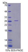 Junctin / ASPH Protein - Recombinant  Aspartate Beta Hydroxylase By SDS-PAGE