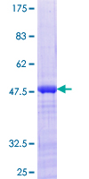 JUNDM2 / JDP2 Protein - 12.5% SDS-PAGE of human JDP2 stained with Coomassie Blue