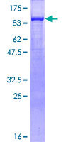 JUP/CTNNG/Junction Plakoglobin Protein - 12.5% SDS-PAGE of human JUP stained with Coomassie Blue
