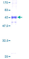 K13 / KCNG Protein - 12.5% SDS-PAGE of human KCNG1 stained with Coomassie Blue