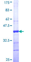 KALRN / KALIRIN Protein - 12.5% SDS-PAGE Stained with Coomassie Blue.