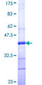 KALRN / KALIRIN Protein - 12.5% SDS-PAGE Stained with Coomassie Blue.