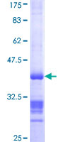 KANK1 Protein - 12.5% SDS-PAGE Stained with Coomassie Blue.