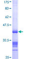 KANK1 Protein - 12.5% SDS-PAGE Stained with Coomassie Blue.