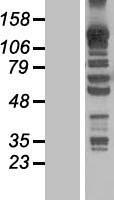 KANK4 Protein - Western validation with an anti-DDK antibody * L: Control HEK293 lysate R: Over-expression lysate