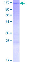 KANK4 Protein - 12.5% SDS-PAGE of human ANKRD38 stained with Coomassie Blue