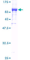 KARS Protein - 12.5% SDS-PAGE of human KARS stained with Coomassie Blue