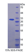 KARS Protein - Recombinant Lysyl tRNA Synthetase By SDS-PAGE