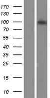 KAT2A / GCN5 Protein - Western validation with an anti-DDK antibody * L: Control HEK293 lysate R: Over-expression lysate