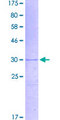 KAT2A / GCN5 Protein - 12.5% SDS-PAGE Stained with Coomassie Blue.