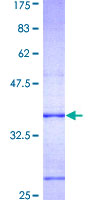 KAT2A / GCN5 Protein - 12.5% SDS-PAGE Stained with Coomassie Blue