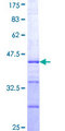 KAT2B / PCAF Protein - 12.5% SDS-PAGE Stained with Coomassie Blue.