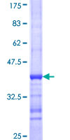 KAT2B / PCAF Protein - 12.5% SDS-PAGE Stained with Coomassie Blue.