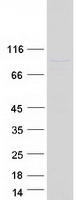 KAT2B / PCAF Protein - Purified recombinant protein KAT2B was analyzed by SDS-PAGE gel and Coomassie Blue Staining