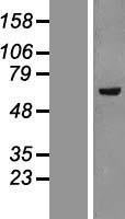 KAT5 / TIP60 Protein - Western validation with an anti-DDK antibody * L: Control HEK293 lysate R: Over-expression lysate