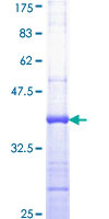 KAT5 / TIP60 Protein - 12.5% SDS-PAGE Stained with Coomassie Blue