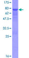KATII / AADAT Protein - 12.5% SDS-PAGE of human AADAT stained with Coomassie Blue