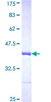 KATII / AADAT Protein - 12.5% SDS-PAGE Stained with Coomassie Blue.