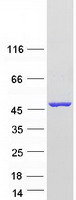 KATII / AADAT Protein - Purified recombinant protein AADAT was analyzed by SDS-PAGE gel and Coomassie Blue Staining