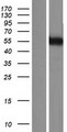 KATNA1 Protein - Western validation with an anti-DDK antibody * L: Control HEK293 lysate R: Over-expression lysate