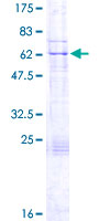 KATNA1 Protein - 12.5% SDS-PAGE of human KATNA1 stained with Coomassie Blue