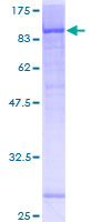 KATNB1 Protein - 12.5% SDS-PAGE of human KATNB1 stained with Coomassie Blue