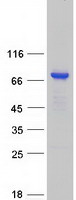 KBTBD11 Protein - Purified recombinant protein KBTBD11 was analyzed by SDS-PAGE gel and Coomassie Blue Staining