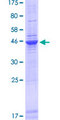 KBTBD12 Protein - 12.5% SDS-PAGE of human KLHDC6 stained with Coomassie Blue