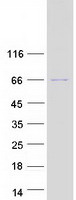 KBTBD12 Protein - Purified recombinant protein KBTBD12 was analyzed by SDS-PAGE gel and Coomassie Blue Staining