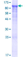 KBTBD6 Protein - 12.5% SDS-PAGE of human KBTBD6 stained with Coomassie Blue