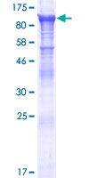 KBTBD7 Protein - 12.5% SDS-PAGE of human KBTBD7 stained with Coomassie Blue