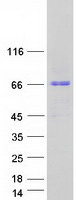 KBTBD8 Protein - Purified recombinant protein KBTBD8 was analyzed by SDS-PAGE gel and Coomassie Blue Staining