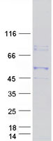 KCMF1 Protein - Purified recombinant protein KCMF1 was analyzed by SDS-PAGE gel and Coomassie Blue Staining