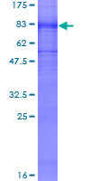 KCNA1 / Kv1.1 Protein - 12.5% SDS-PAGE of human KCNA1 stained with Coomassie Blue
