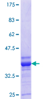 KCNA1 / Kv1.1 Protein - 12.5% SDS-PAGE Stained with Coomassie Blue.