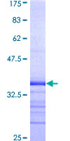 KCNA3 / Kv1.3 Protein - 12.5% SDS-PAGE Stained with Coomassie Blue.