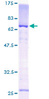 KCNAB1 Protein - 12.5% SDS-PAGE of human KCNAB1 stained with Coomassie Blue