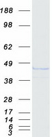 KCNAB1 Protein - Purified recombinant protein KCNAB1 was analyzed by SDS-PAGE gel and Coomassie Blue Staining