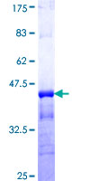 KCNC3 / Kv3.3 Protein - 12.5% SDS-PAGE Stained with Coomassie Blue.