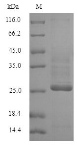 KCND1 / Kv4.1 Protein - (Tris-Glycine gel) Discontinuous SDS-PAGE (reduced) with 5% enrichment gel and 15% separation gel.