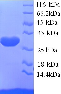 KCND2 / Kv4.2 Protein