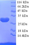 KCND2 / Kv4.2 Protein